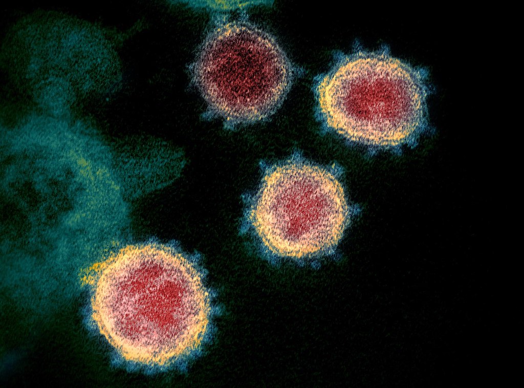Epidemia koronawirusa, wirus SARS-CoV-2 pod mikroskopem elektronowym – Foto: NIAID-RML